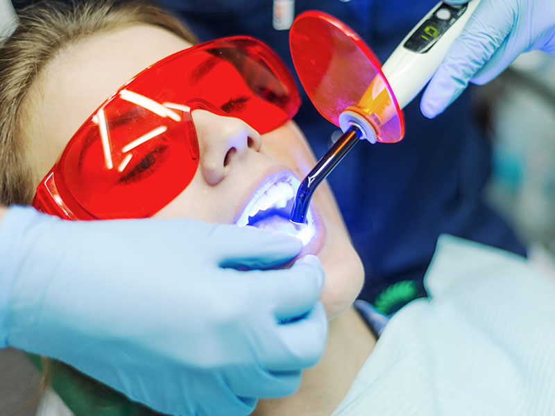 The Antimicrobial Effect of Cold Atmospheric Plasma against Dental Pathogens-A Systematic Review of In-Vitro Studies